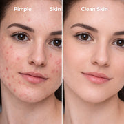 Skin Care Kit
