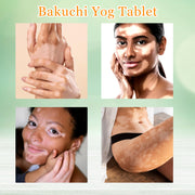 Bakuchi Yog Tablet - 60Tab