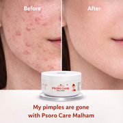 Skin Care Kit