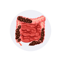 Relieves Chronic Constipation