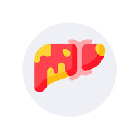 Fatty Liver