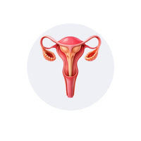 Ovarian Cyst