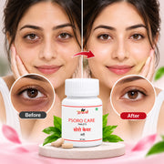 Psoro Care Tablet - 60Tab