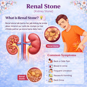 Renal Stone Kit