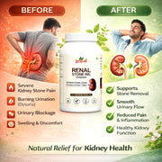 Renal Stone Nil Powder  - 100gm